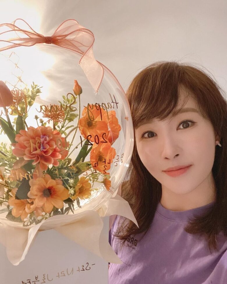 キムソナ 現在の結婚や熱愛彼氏の噂は 整形疑惑について